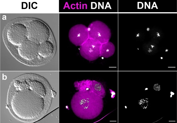 Breakthrough Study Demonstrates Viability of Ambient Temperature Transport for Human Oocytes, Unlocking New Research Opportunities