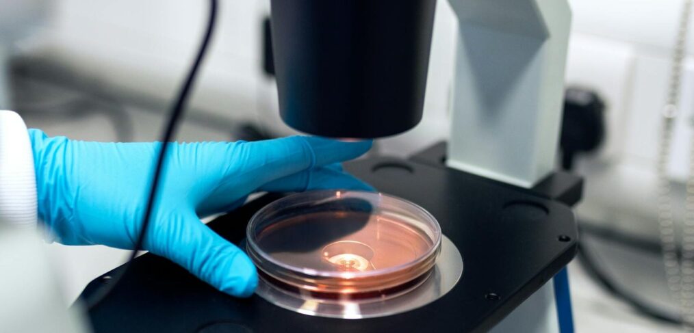 Scientist using a microscope to examine petri dish samples in a laboratory setting.